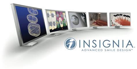 Boosting Smile Confidence with Insignia: A Revolution in Orthodontic Treatment