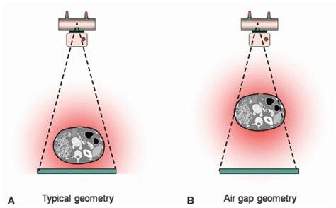 Pengendalian Scatter Radiation dalam Radiografi